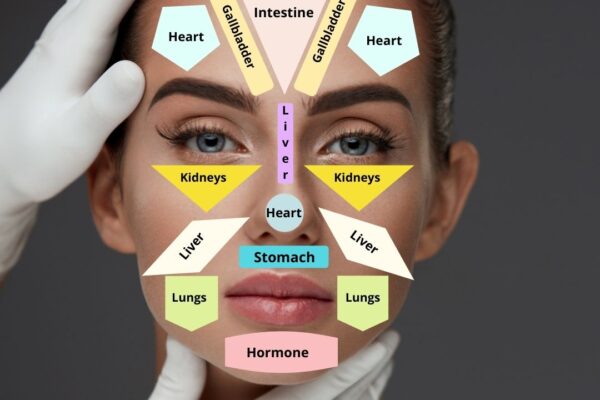 Acne mapping and skin concerns