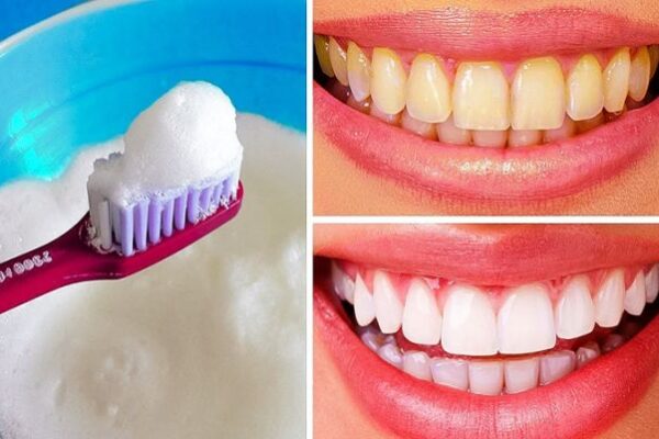Natural Ways to Whiten Your Teeth at Home