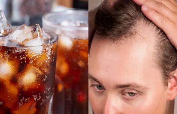Too many sugary drinks may trigger hair loss, study finds