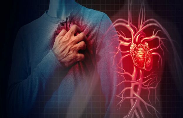 Half of Pakistan’s heart patients are below 49, cardiologists report