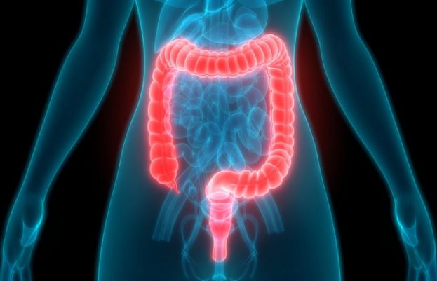 Simple Daily Habits Could Reduce Risk of Constipation and Bowel Cancer
