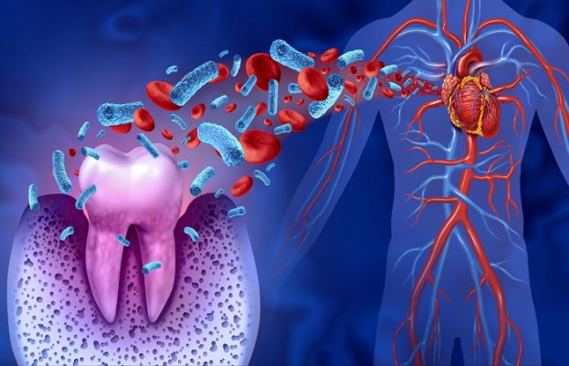 Oral bacteria may increase heart diseases risk Oral bacteria may increase heart diseases risk